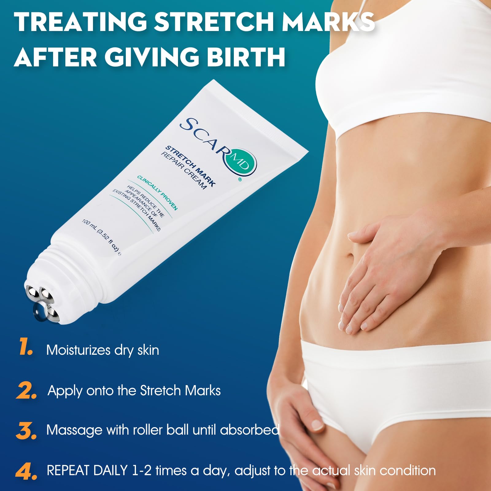 ScarMD Stretch Mark Repair Cream packaging box highlights convenient daily use.