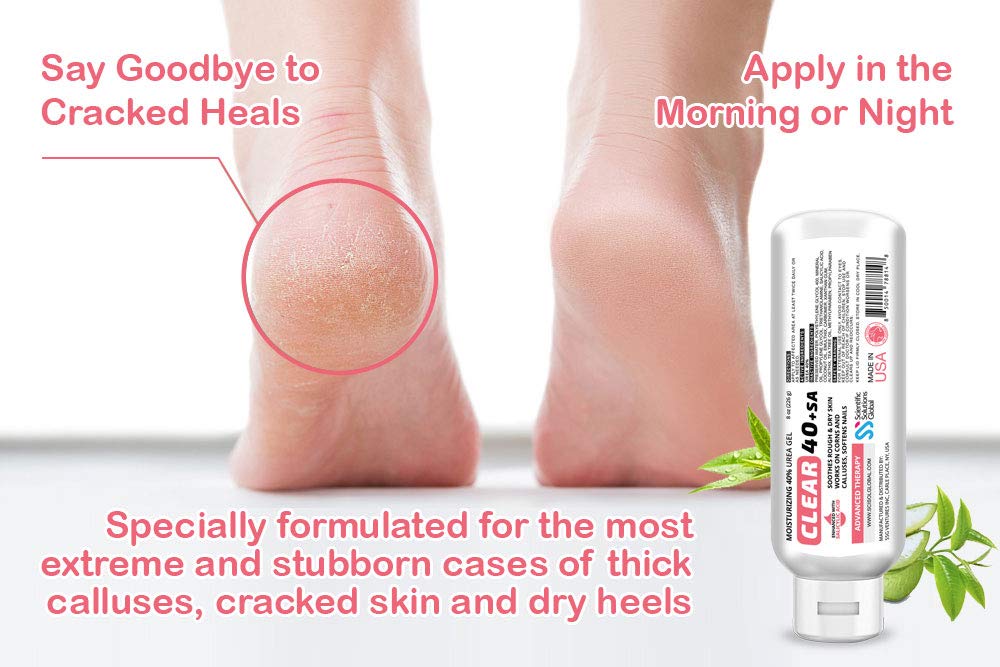 CLEAR 40 +SA Gel being applied to dry feet
