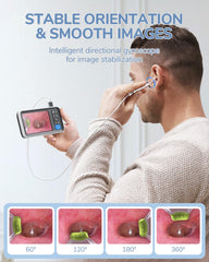 ScopeAround otoscope gyroscope keeps images stable during inspection.