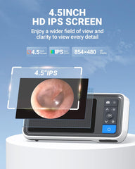 ScopeAround otoscope silicone scoopers included for safe earwax removal.