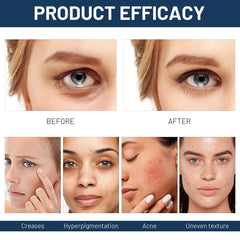 Scrlous Paracress Oil label closeup highlights organic ingredients for sensitive skin care.