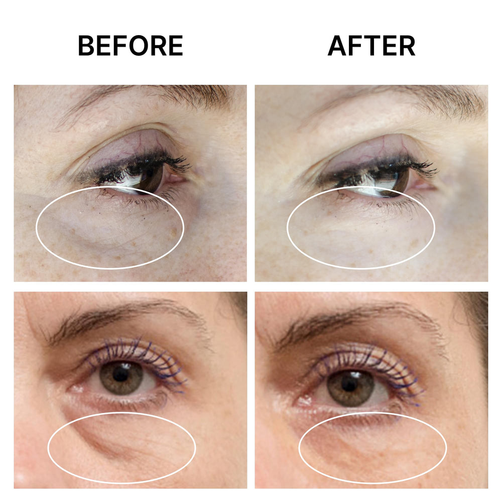 SEAMANTIKA Eye Cream application tap—gentle dab provides firming lift without mess