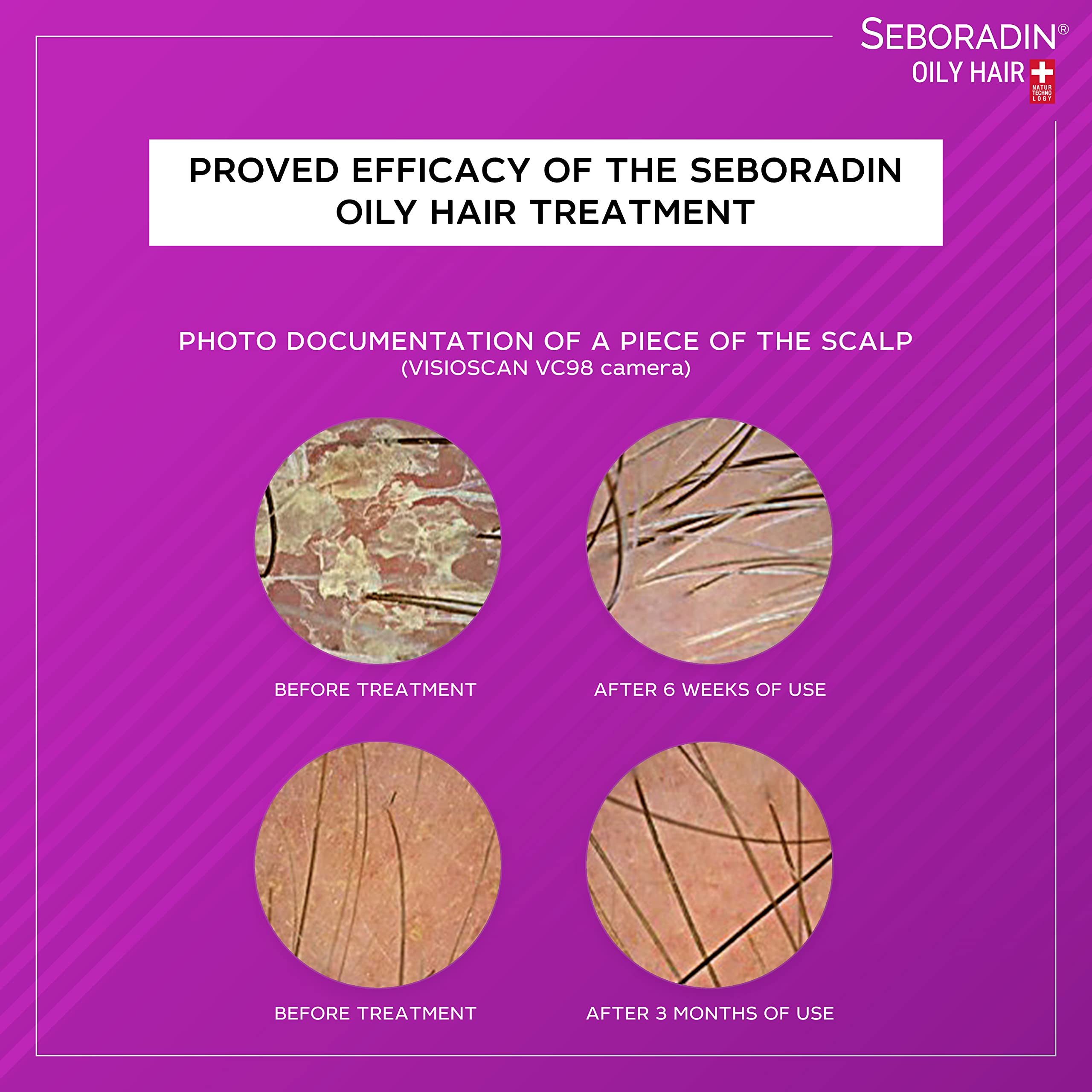Seboradin essential oils and plant extracts photo — hydrating and strengthening effect.