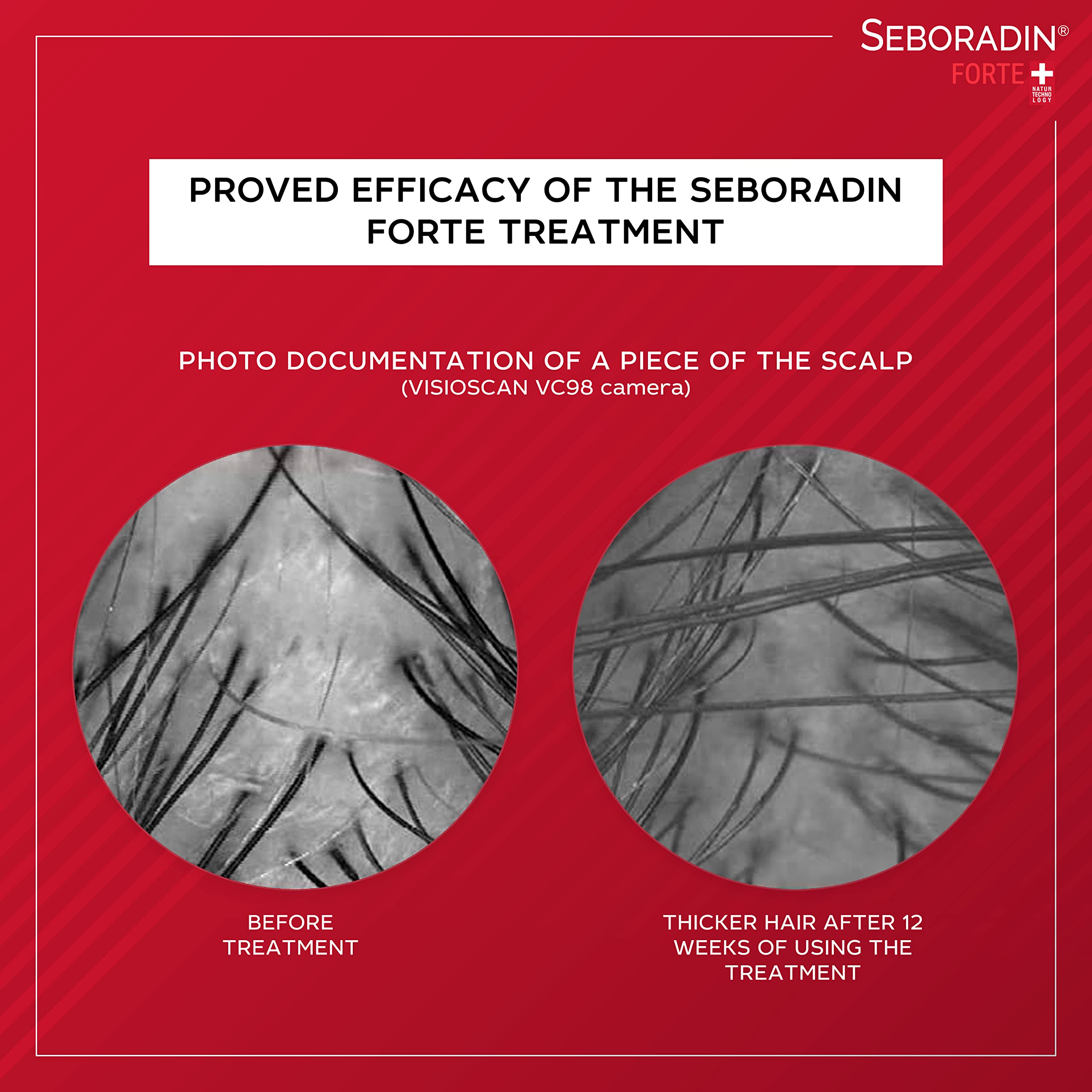 Seboradin hops illustration hints strengthening and revitalizing hair fibers.