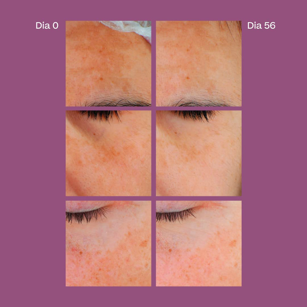 Sensilis D-Pigment Serum ATX B3 for summer use, compatible with sun protection.