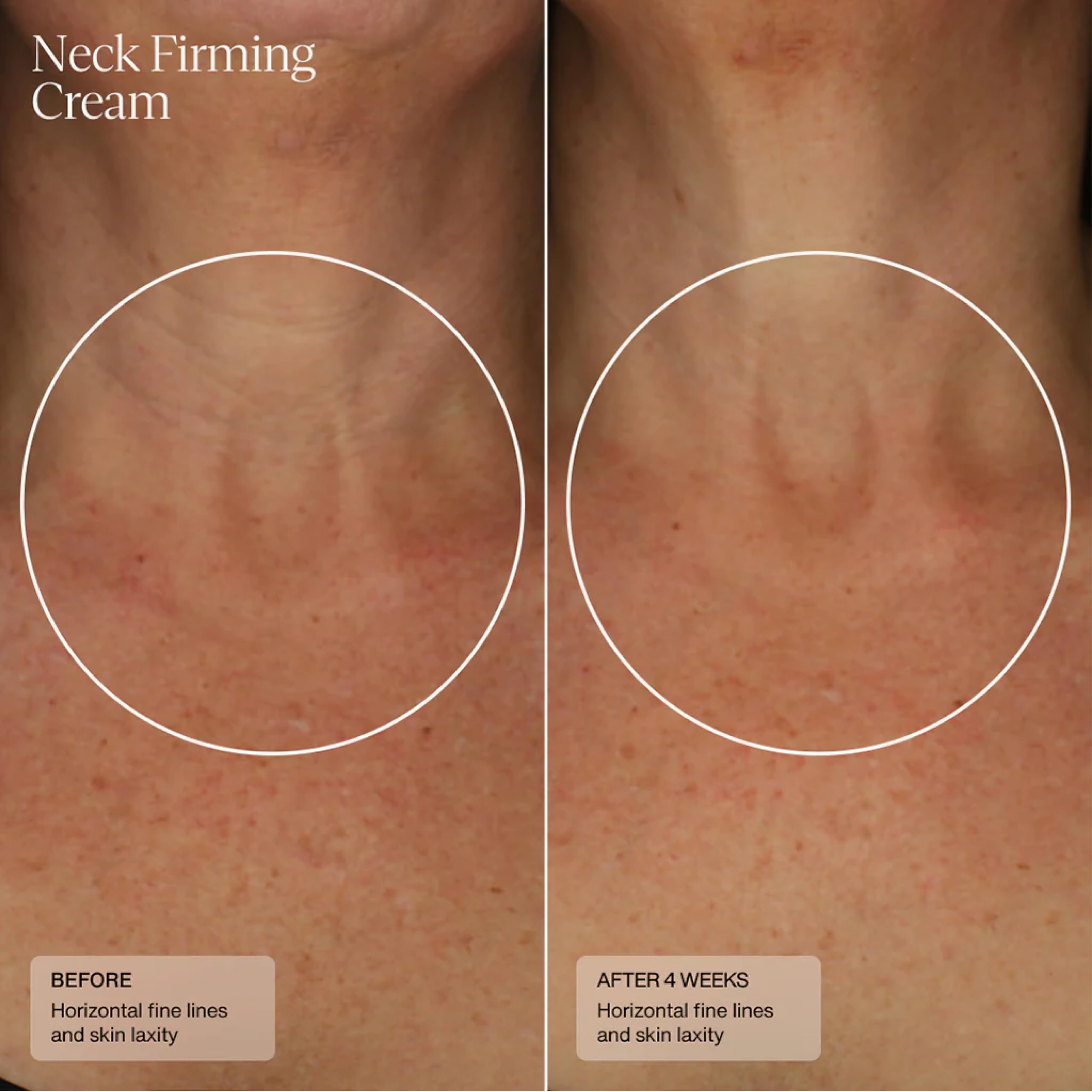 Sente caffeine and vitamin C boost for skin.