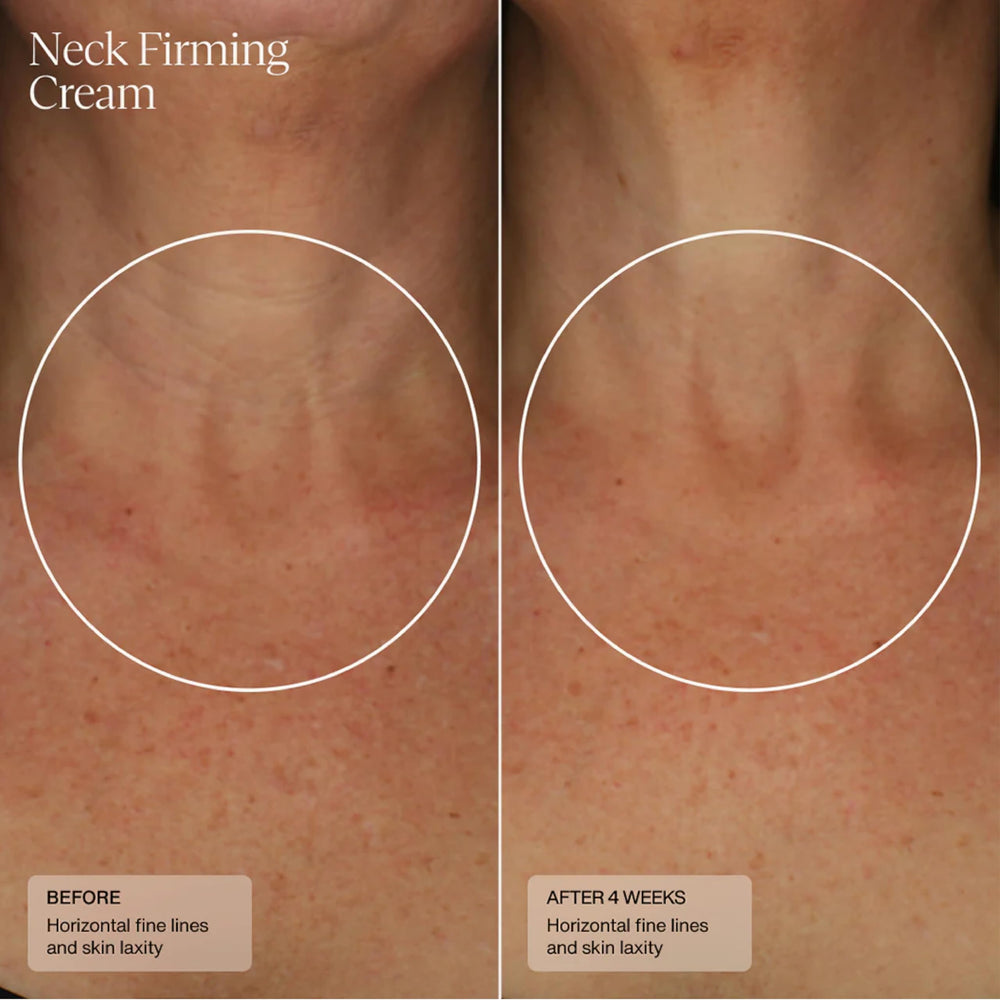 Sente caffeine and vitamin C boost for skin.