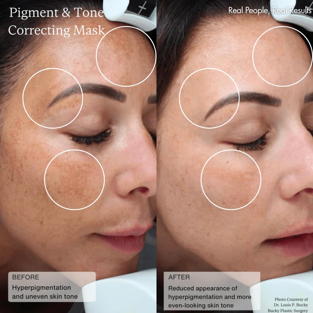 Sente Cysteamine HSA cream texture close-up showing smooth, rich consistency