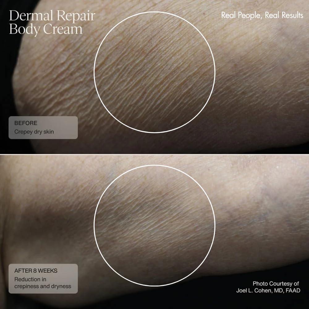 User applying Sente cream to leg for lasting moisture