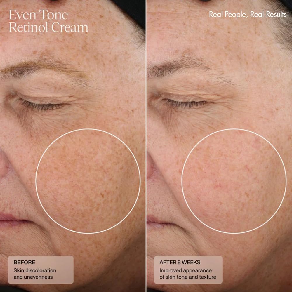 Sente Even Tone Retinol Cream demonstrates potential for improved tone and texture