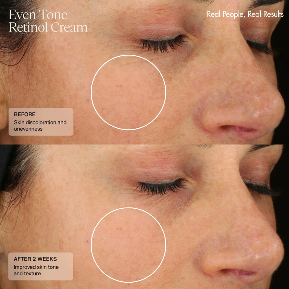 Sente HSA technology graphic illustrating hydration support for the skin