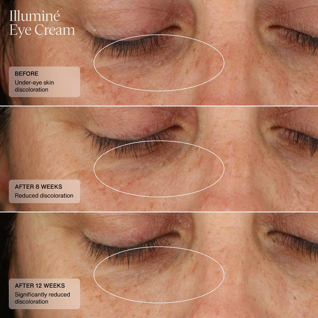 Sente Illumine Eye Cream clinical study result showing 93% improvement