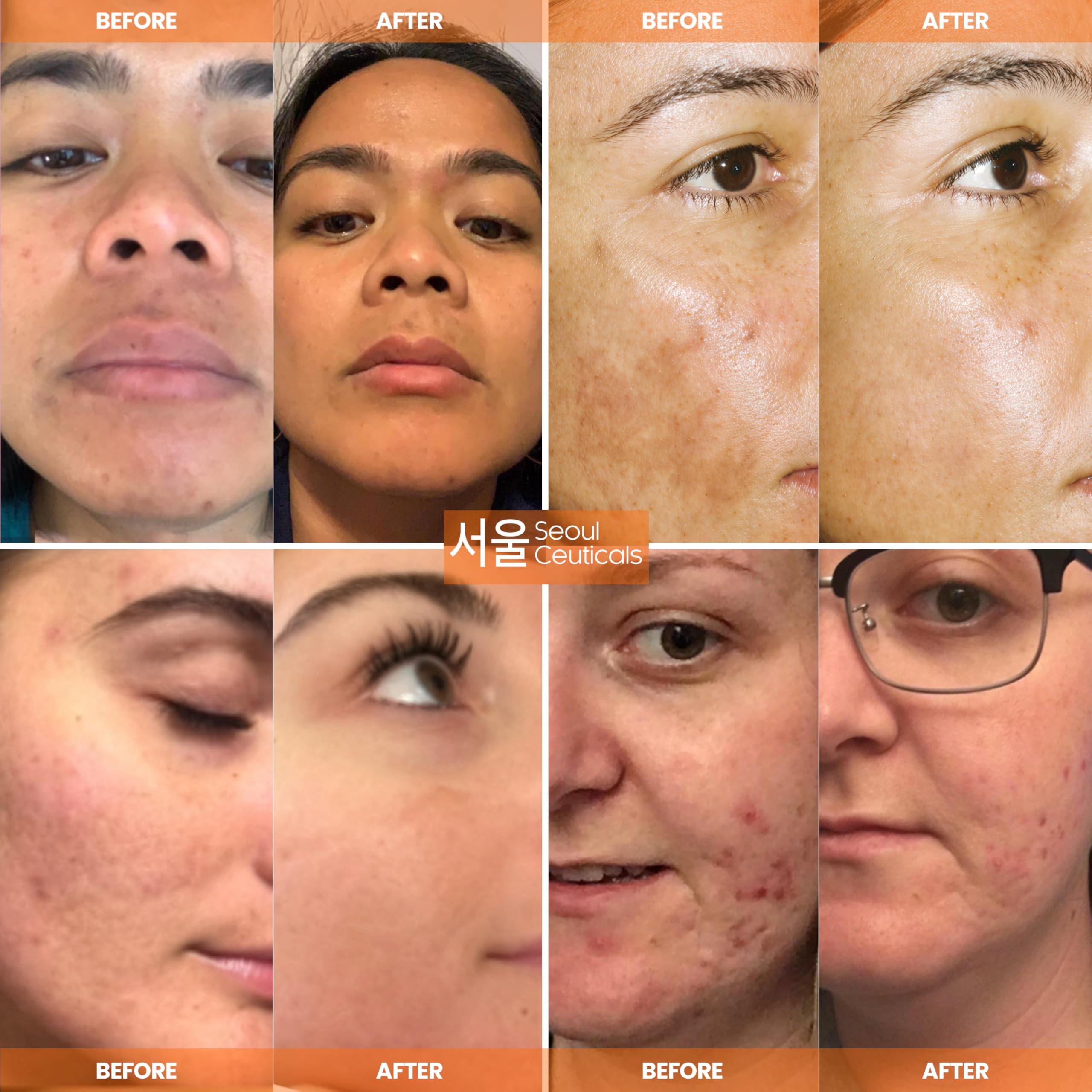 Amber bottle protects vitamin C actives while signaling premium skincare
