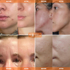 SeoulCeuticals snail mucin moisturizer texture on hand shows absorption.