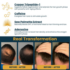 Seraphime Copper Peptide Serum applied to scalp signaling potential density support.