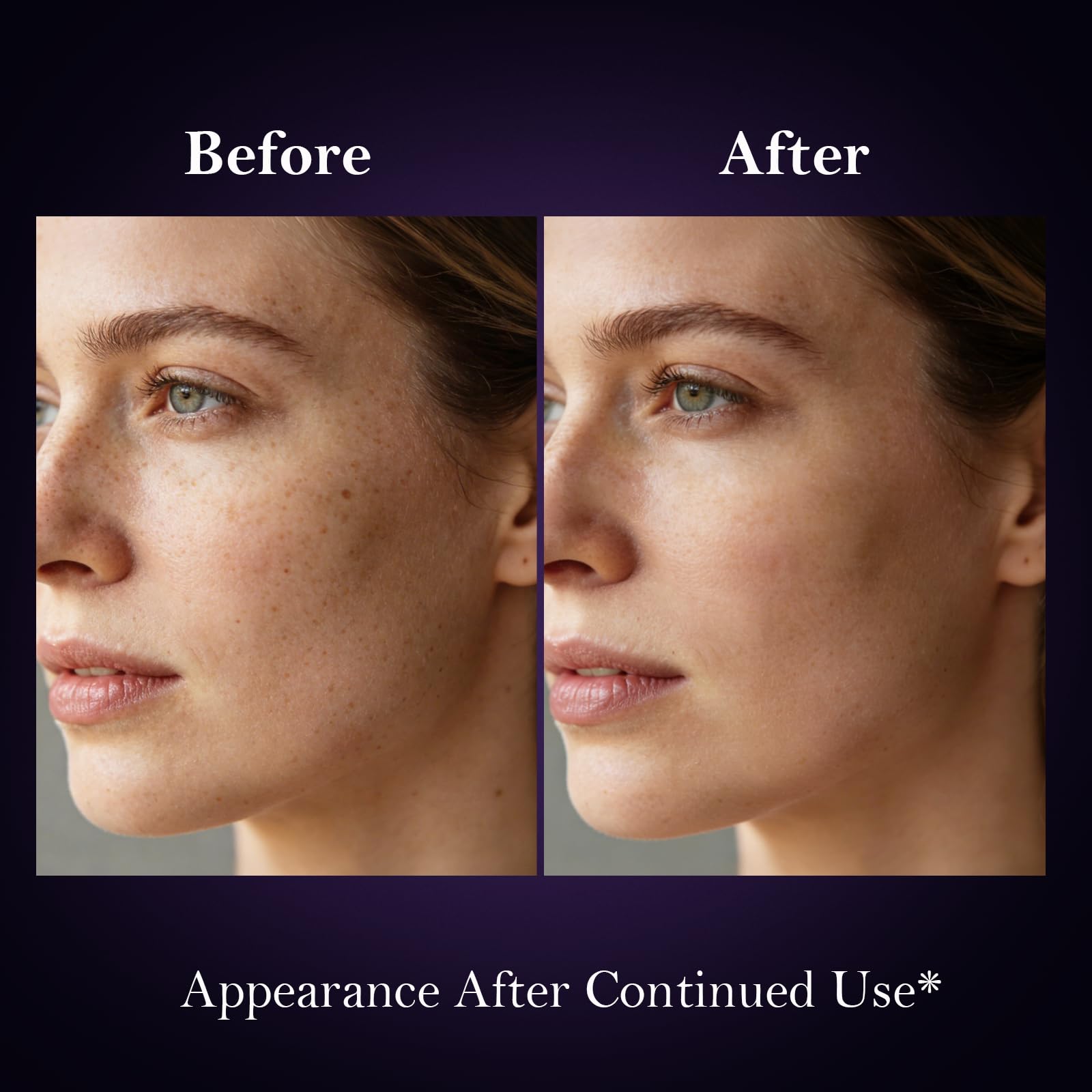 SerenSkin dark-spot remover lightweight formula glides on and layers well with other products.
