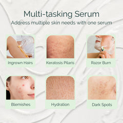 Serious Serum AHAs and BHAs blend exfoliate for smoother texture