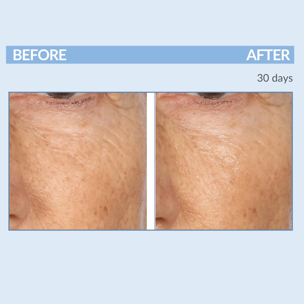Serious Skincare A Force XR serum daily use for routine skincare