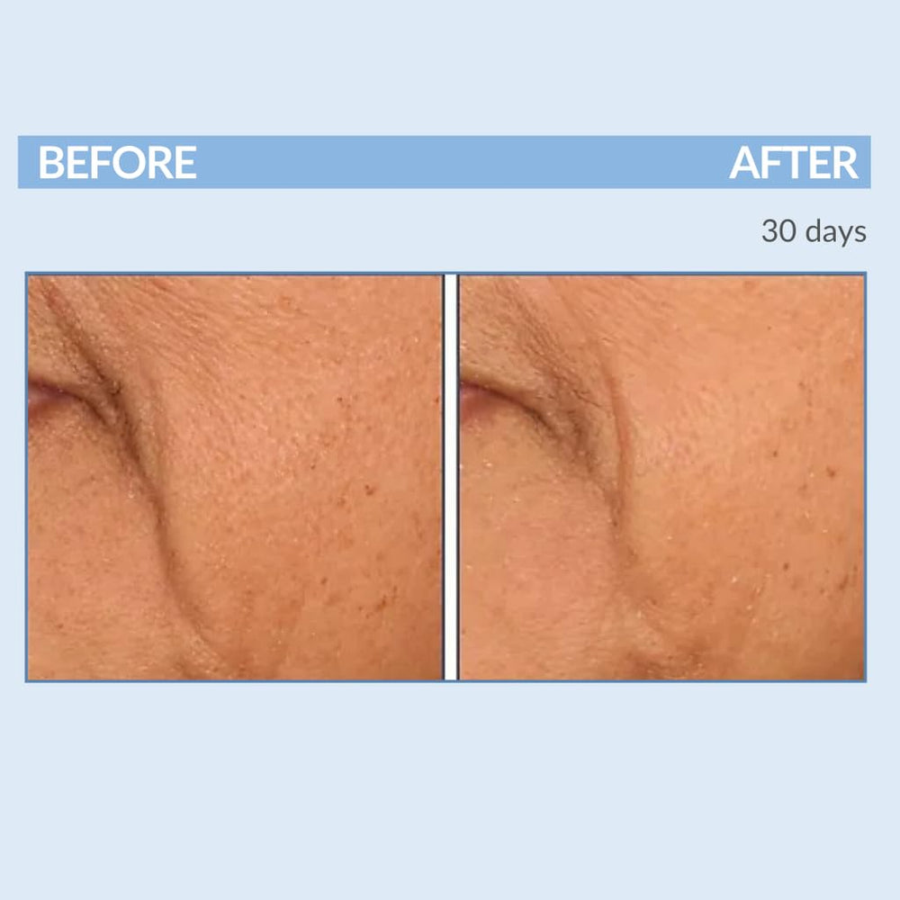 Serious Skincare A Force XR encapsulated retinol close-up for gentle exfoliation