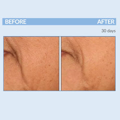 Serious Skincare A Force XR encapsulated retinol close-up for gentle exfoliation