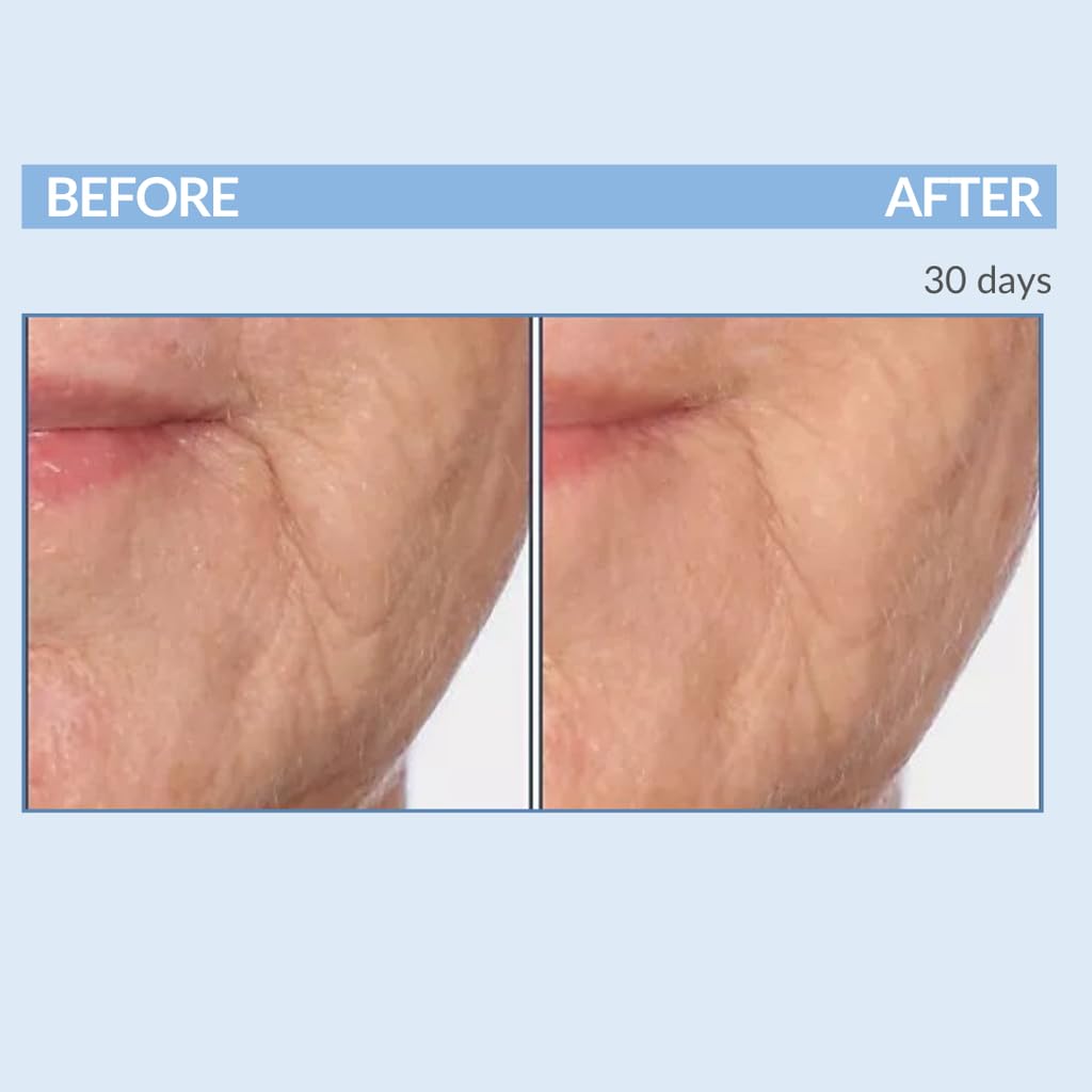 Serious Skincare A Force XR serum with green tea extract for soothing care