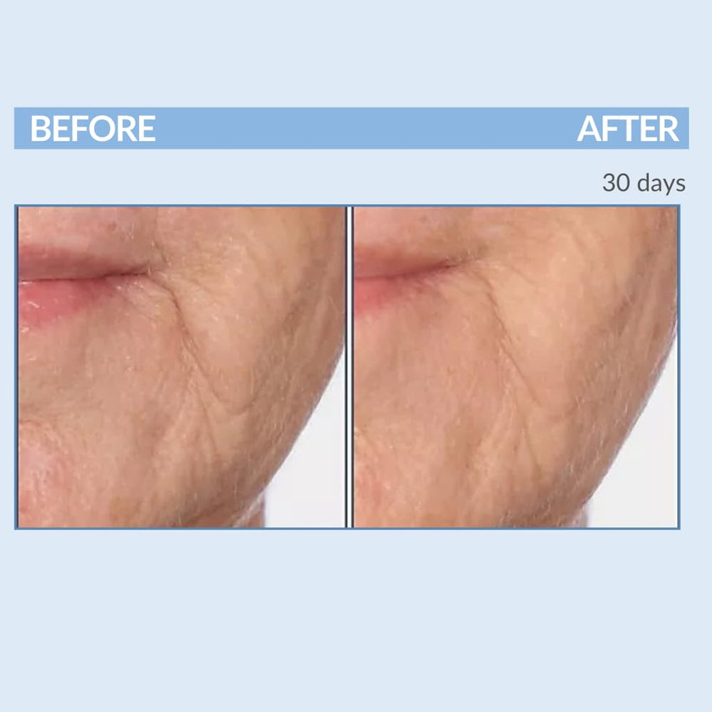 Serious Skincare A Force XR serum with green tea extract for soothing care
