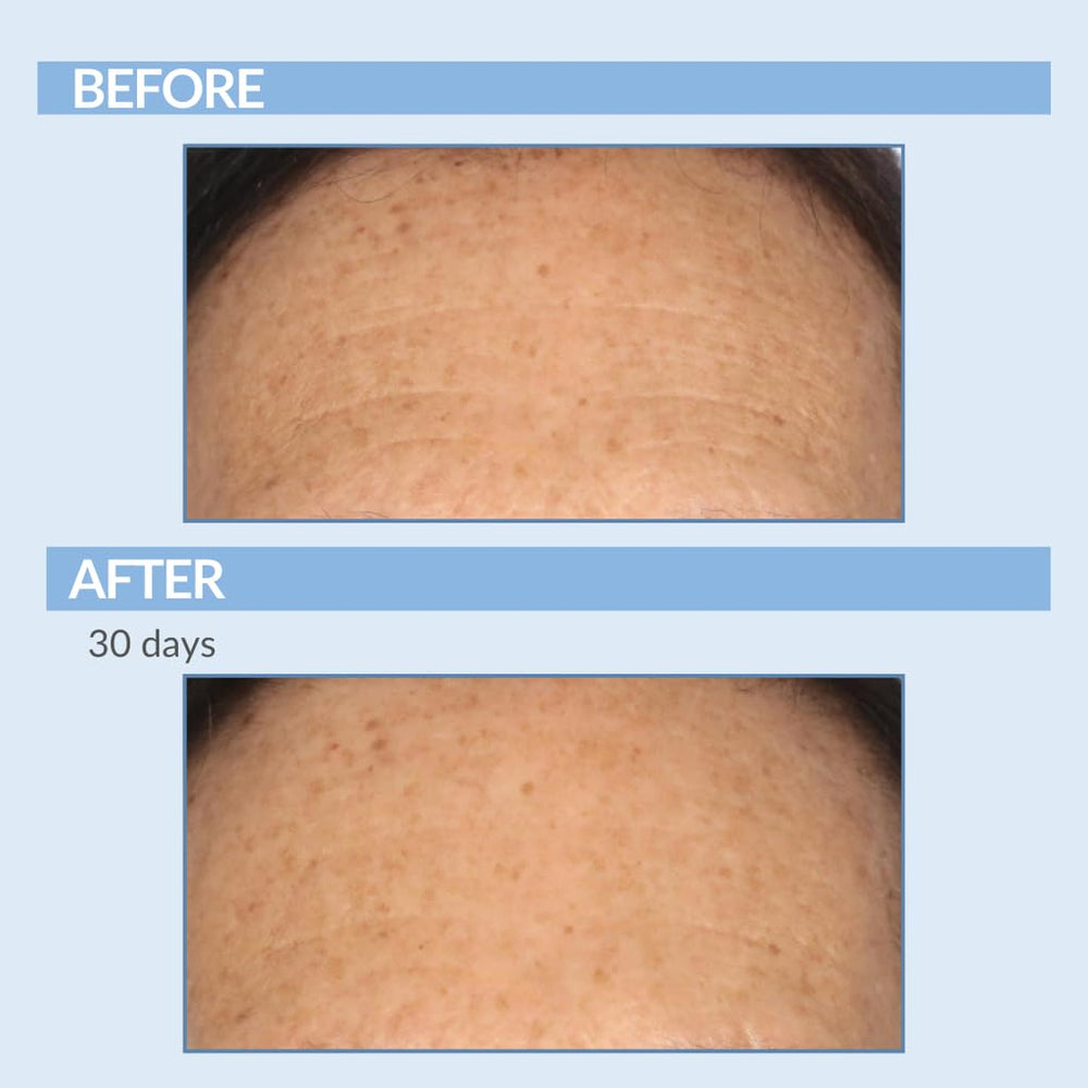 Serious Skincare A Force XR serum on hand shows quick absorption