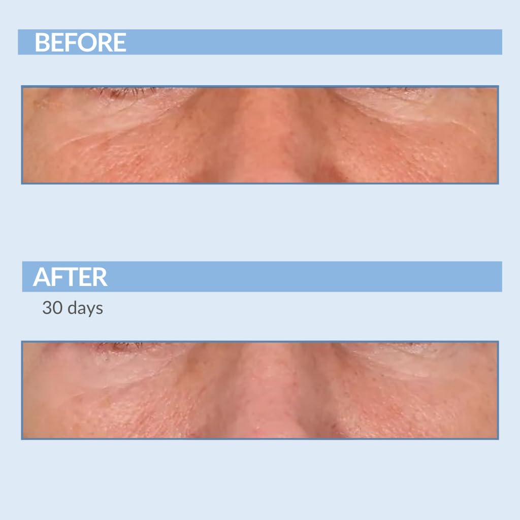 Serious Skincare A Force XR serum quick absorption after application