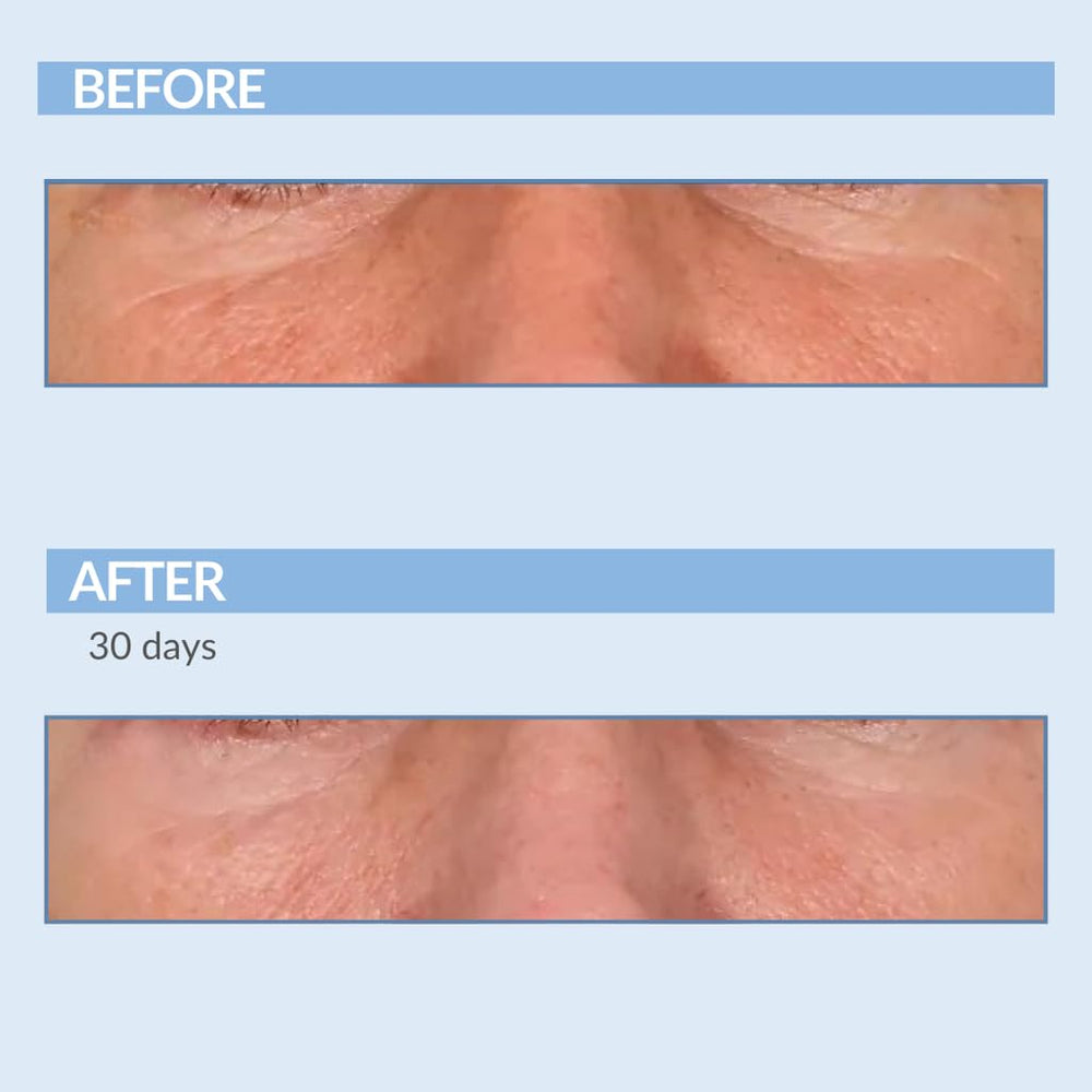 Serious Skincare A Force XR serum quick absorption after application