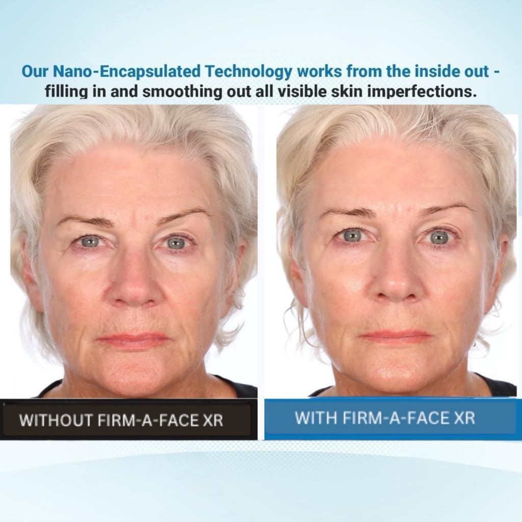 Firm A Face XR invisible lift looks subtle and seamless on skin