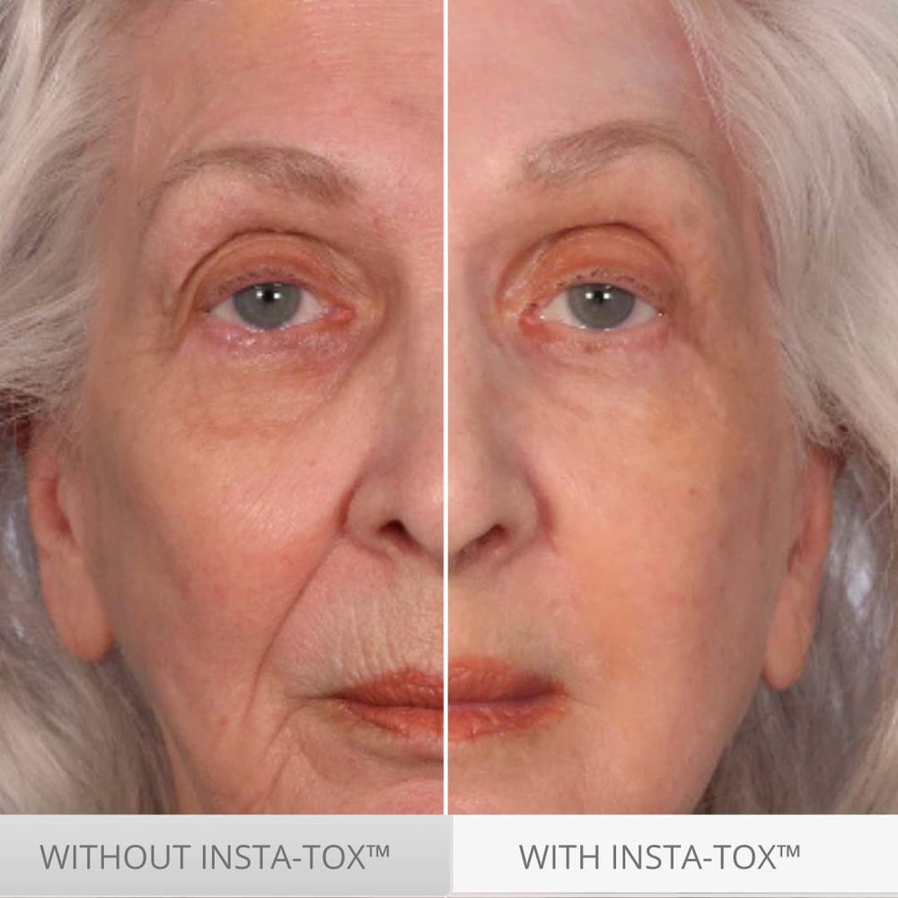 Serious Skincare INSTA-TOX quick absorption helps skin feel smooth