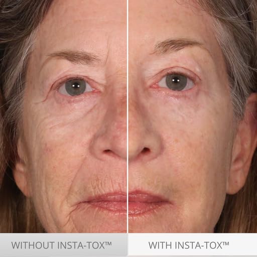 INSTA-TOX texture swatch reveals creamy formula for easy application.