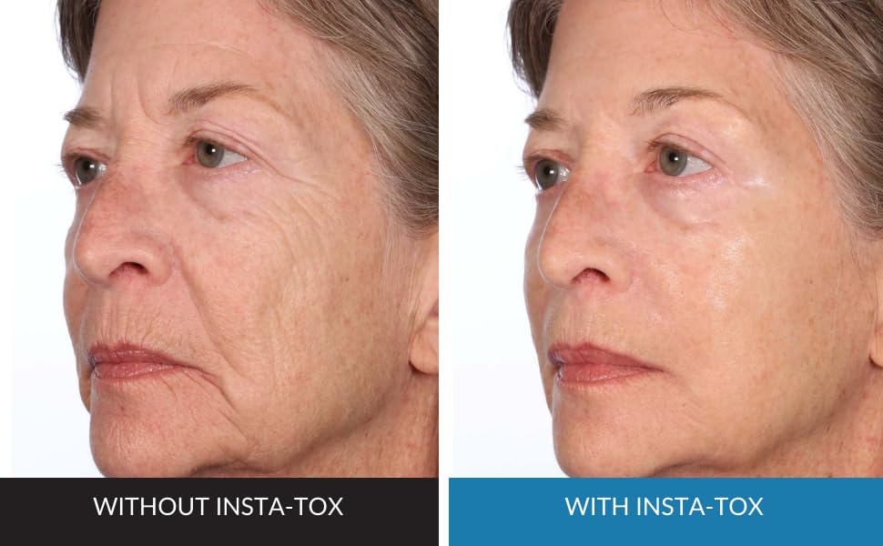 Close-up of Insta-Tox texture showing tightening feel on skin.