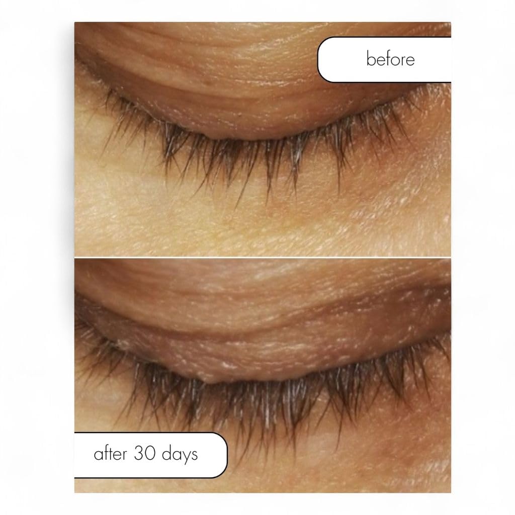 Serious Skincare Clover Flower extract supports lash conditioning.