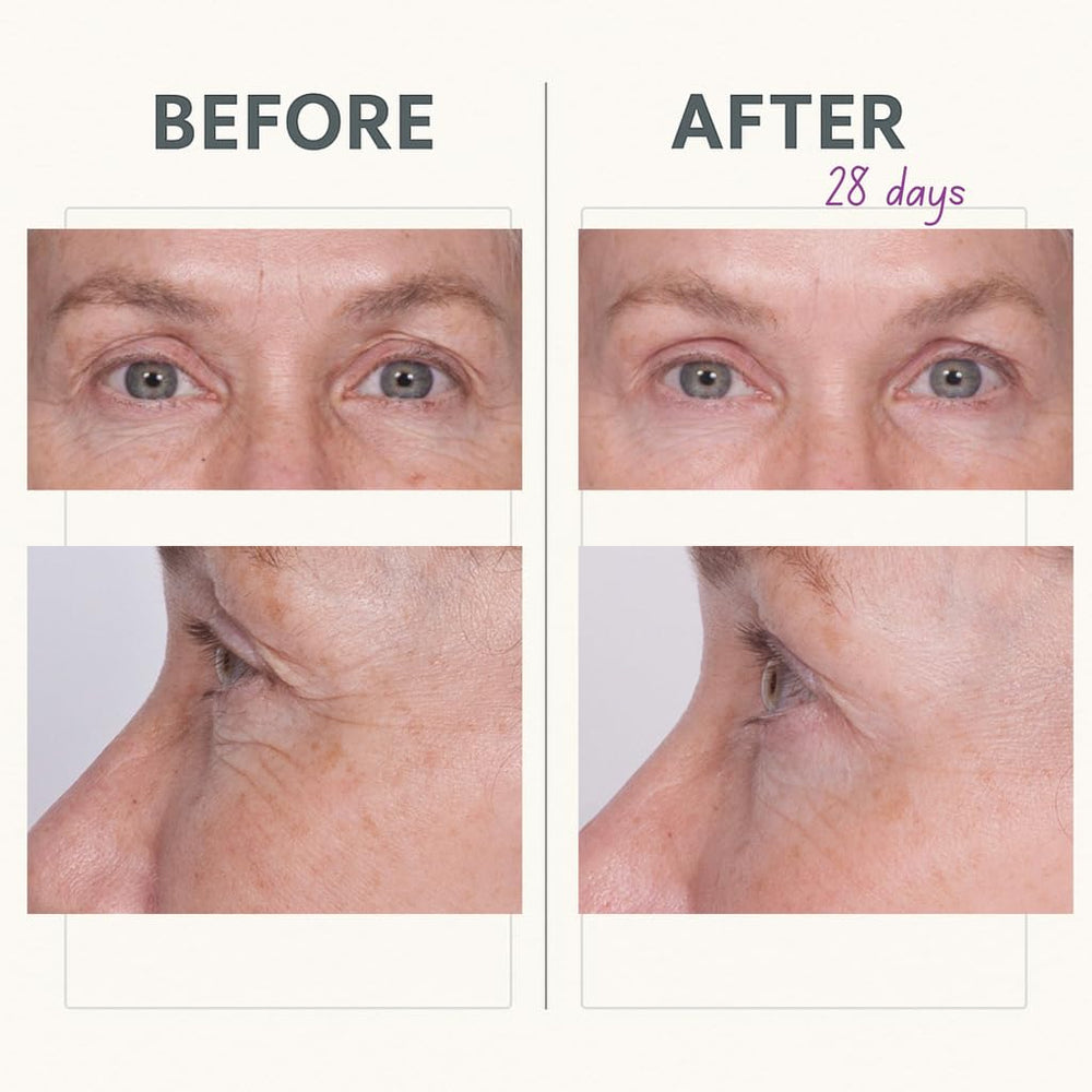 Product tube and cap display of Serious Skincare Reverse Lift Eye Cream.