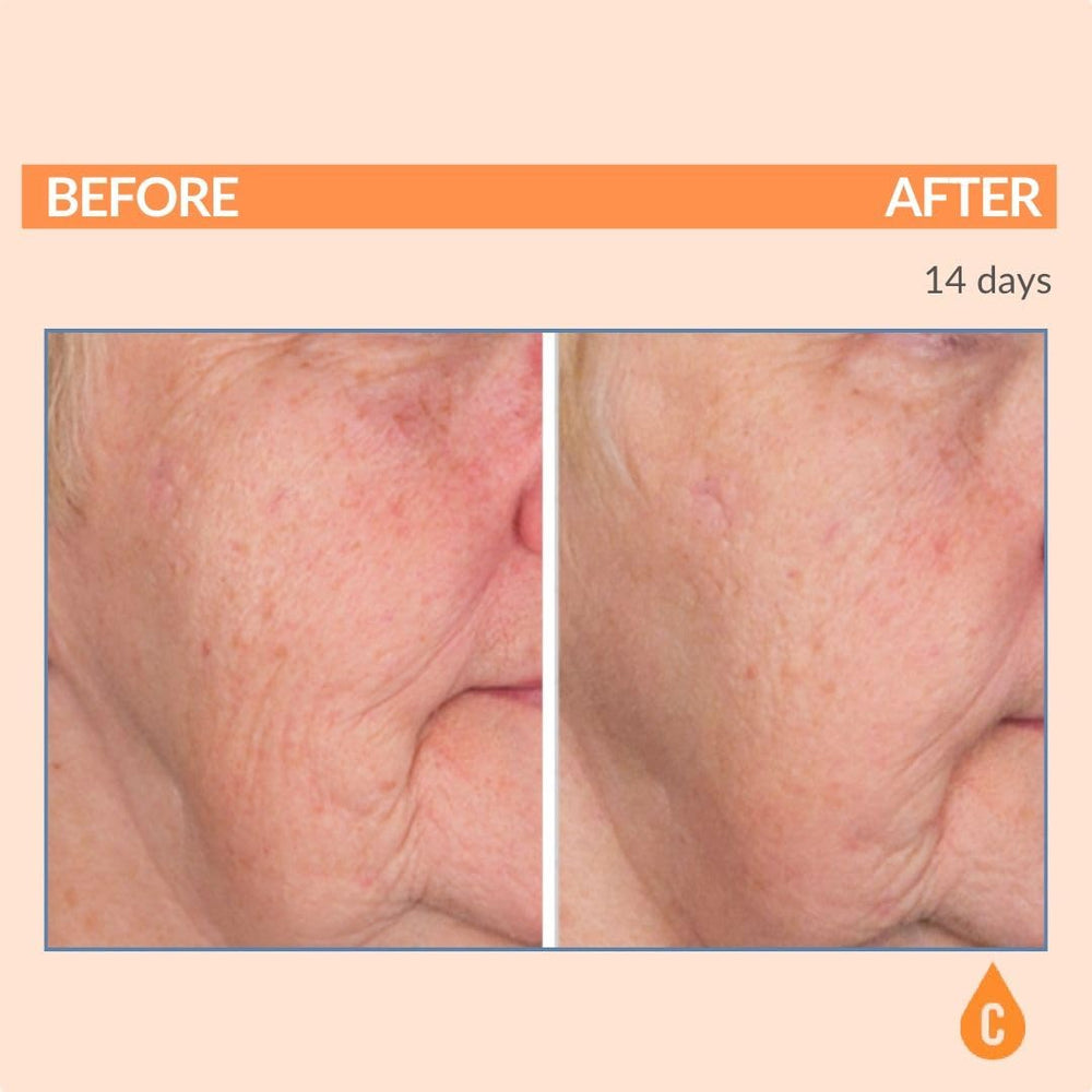 Serious Skincare Serious-C3 Plasma Restore application on face and neck for smoothing