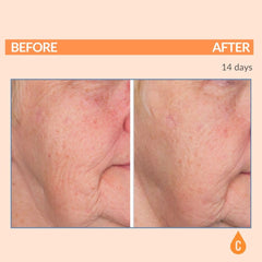 Serious Skincare Serious-C3 Plasma Restore application on face and neck for smoothing