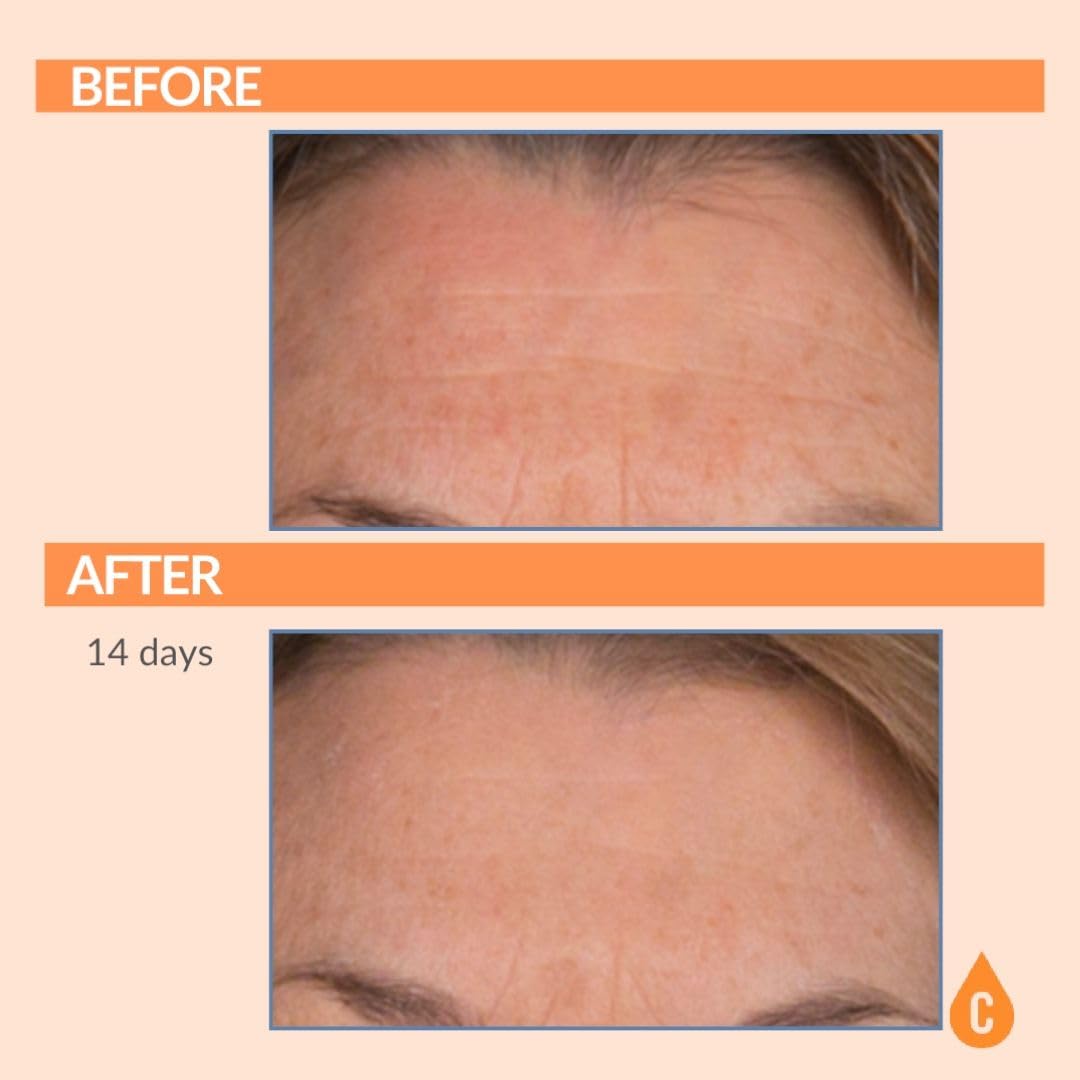 Serious Skincare Serious-C3 Plasma Restore lid-off shot to reveal creamy formula