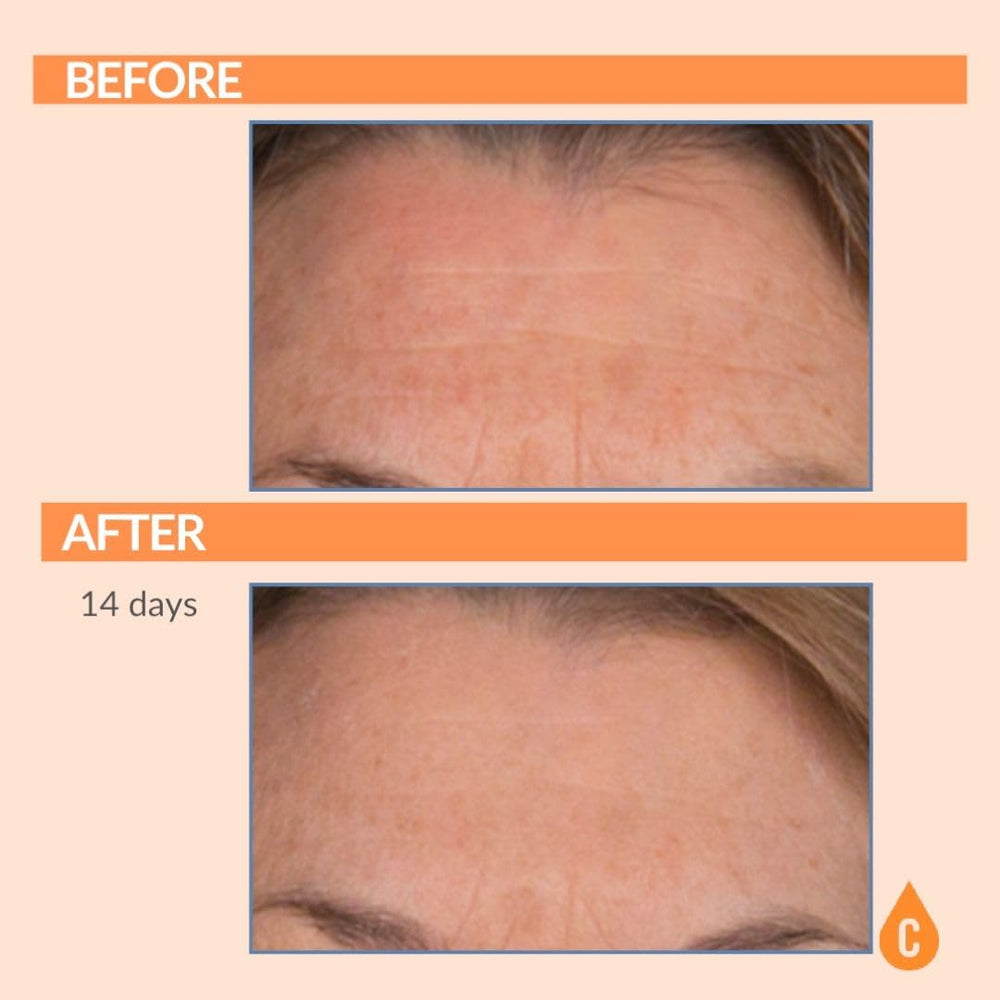 Serious Skincare Serious-C3 Plasma Restore lid-off shot to reveal creamy formula