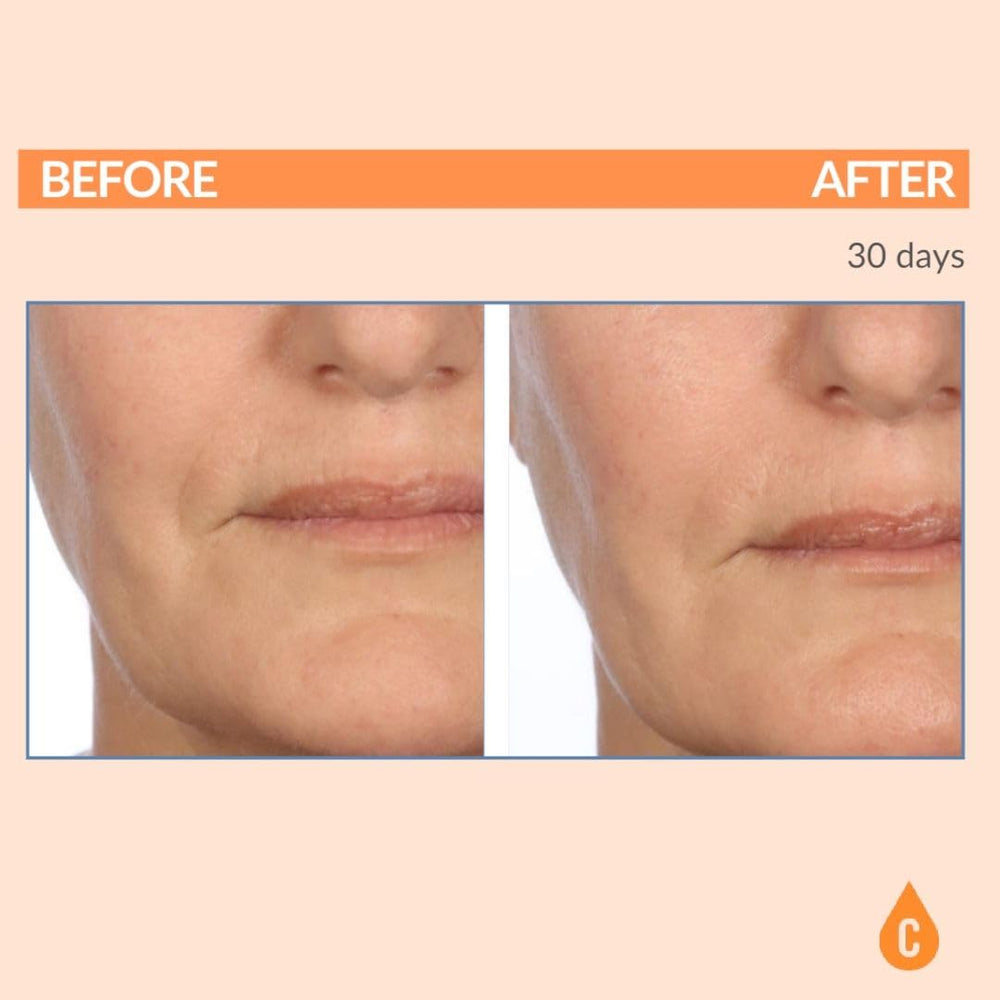 Serious Skincare Serious-C3 Plasma Restore texture detail on skin for glow