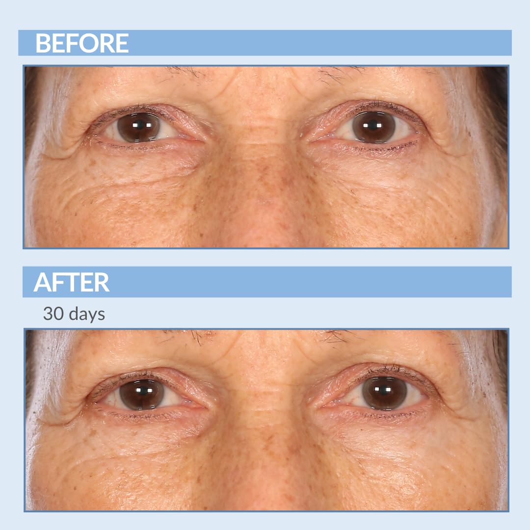 Serious Skincare Vitamin A Force XR texture close-up showing lightweight absorption