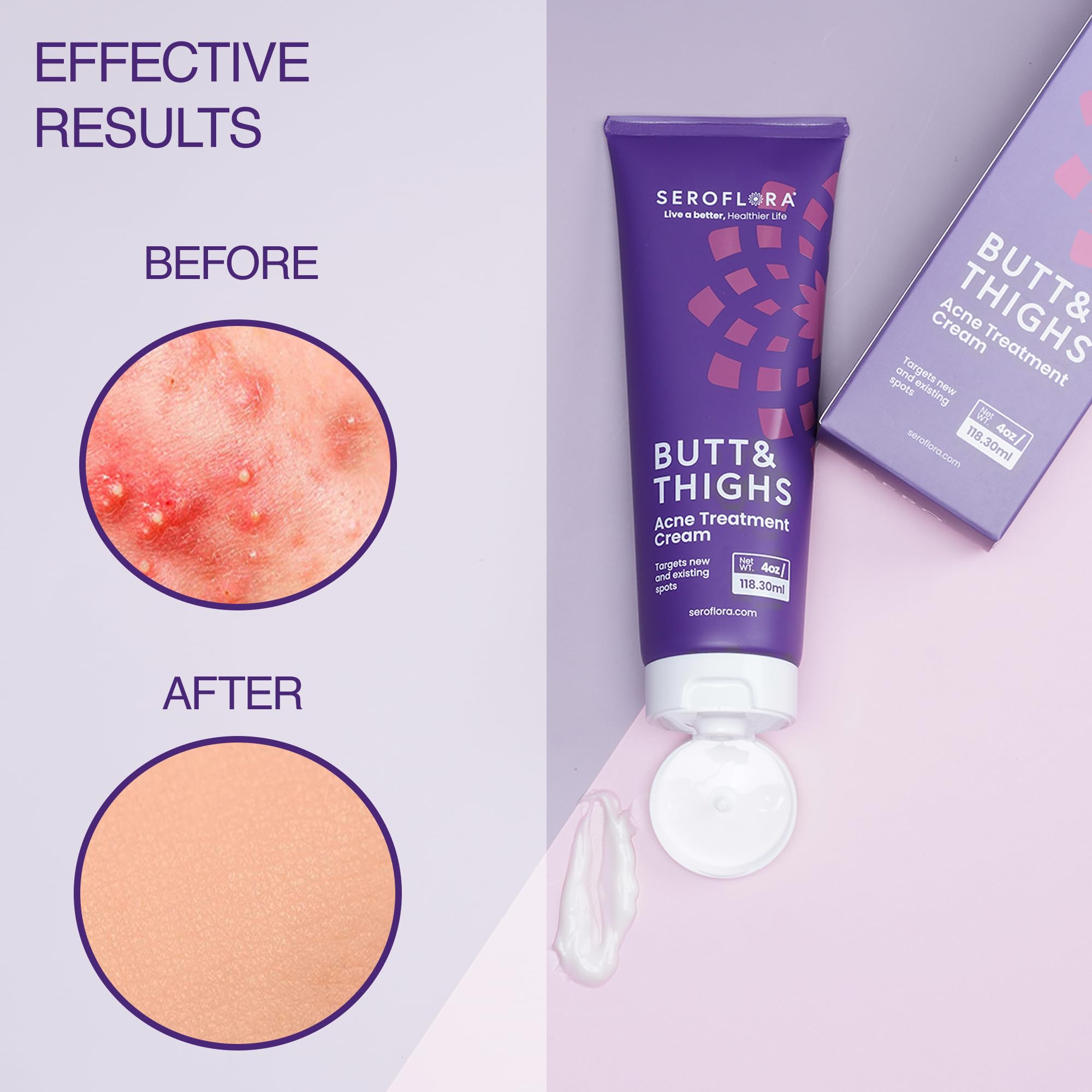 Seroflora tube-dispensing view emphasizes easy butt-area application.
