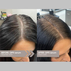 OPTI serum dropper application demonstrates easy daily scalp use