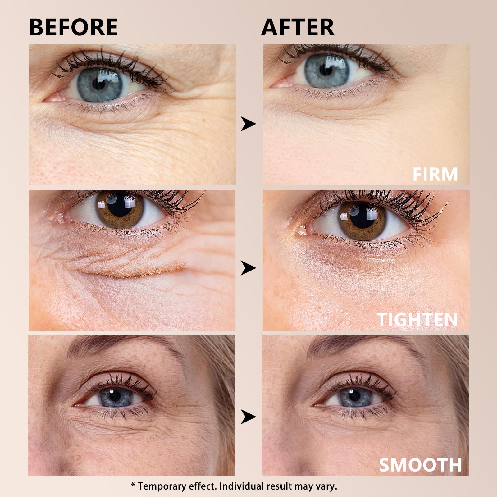 Seyoulala puffiness reduction close-up shows refreshed under-eye area.