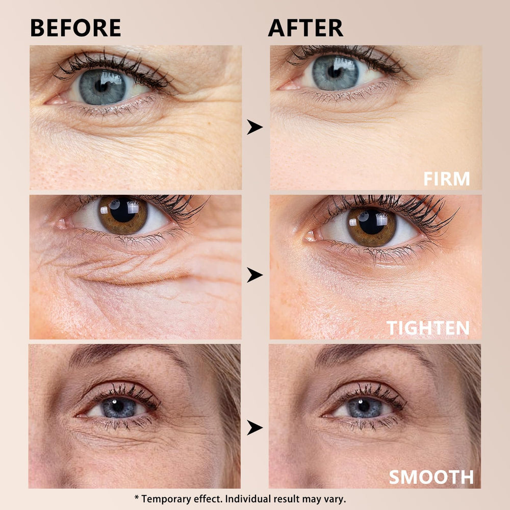 Seyoulala puffiness reduction close-up shows refreshed under-eye area.