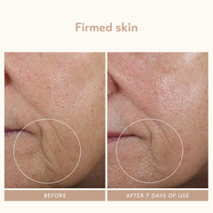 Shani Darden wand flat disc on neck for a firmer feel