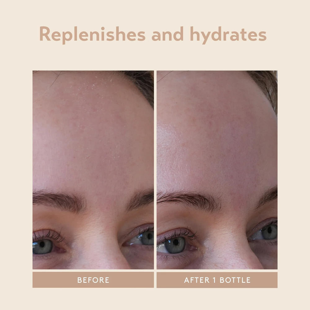 Skin after applying SHANI DARDEN Hydration Peptide Cream shows improved texture.