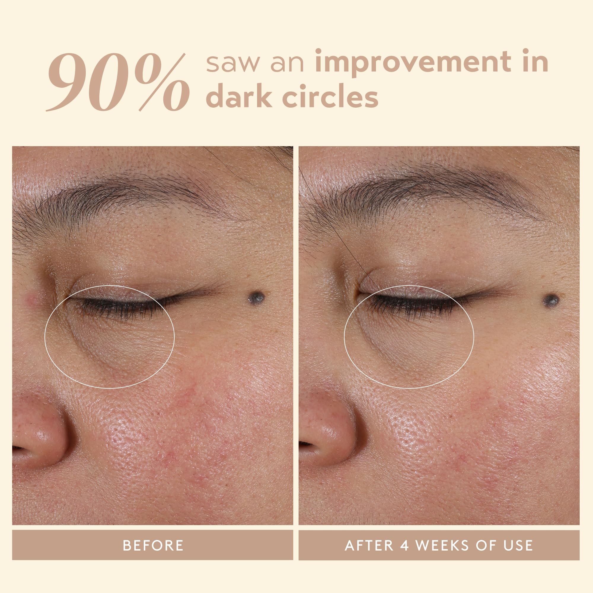 SHANI DARDEN Intensive Eye Renewal Cream ingredients Niacinamide and Ceramide on label.