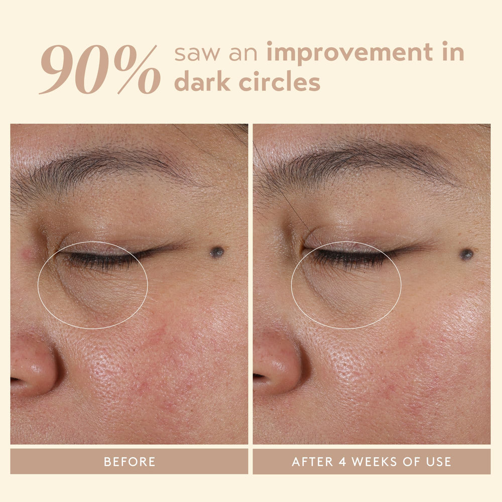SHANI DARDEN Intensive Eye Renewal Cream ingredients Niacinamide and Ceramide on label.