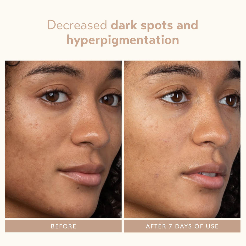 SHANI DARDEN Lactic Acid Serum application closeup demonstrates smooth, even skin prep